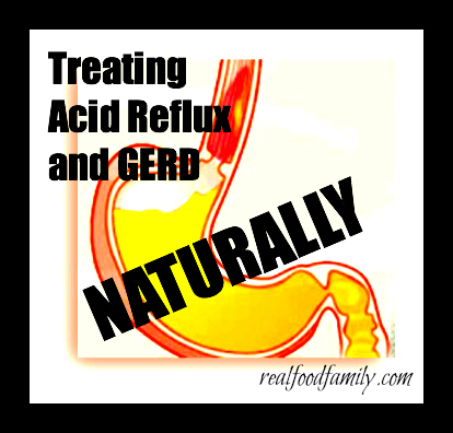  talking about Acid Reflux and GERD (Gastroesophageal Reflux Disease