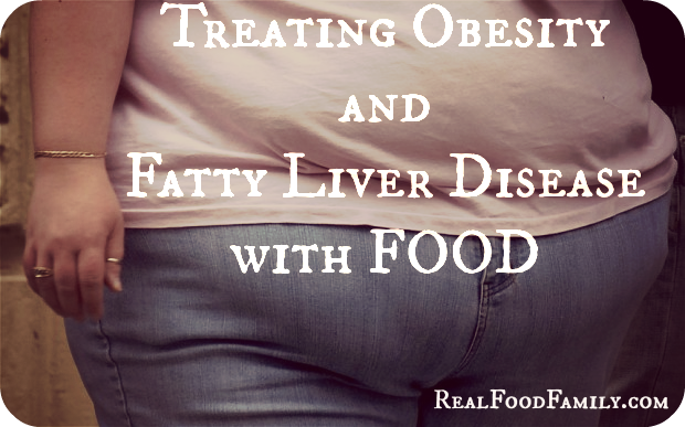 obesity and fatty liver disease