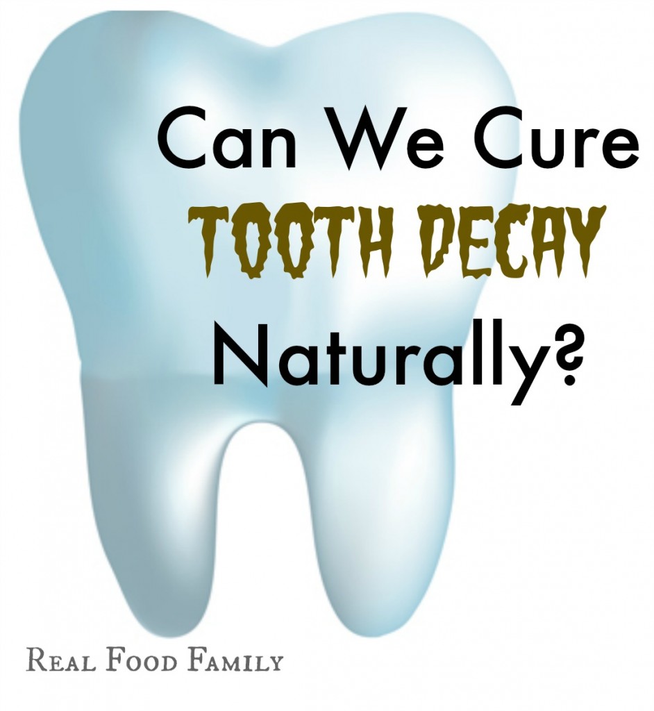 Can We Cure Our Kid's Tooth Decay NATURALLY?